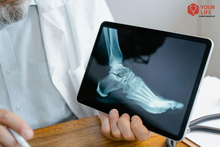 Ortopedie și Traumatologie Suceava_ Clinica Your Life